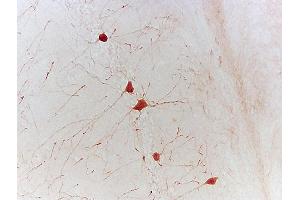 Formalin-fixed and paraffin embedded mouse hippocampus labeled with Rabbit Anti-phospho-CREB-1(Ser133) Polyclonal Antibody, Unconjugated 1:500 followed by conjugation to the secondary antibody (CREB1 anticorps  (pSer133))