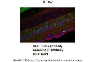 Application: Immunofluorescence Species+tissue/cell type: Mouse retina Primary antibody dilution: 1:200 Secondary antibody: Goat anti-rabbit Alexafluor 568 Secondary antibody dilution: 1:200 - See more at: (TPD52 anticorps  (Middle Region))