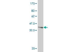 Western Blot detection against Immunogen (38.