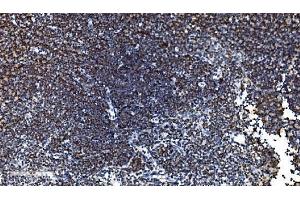 IHC analysis of CDC45L using anti-CDC45L antibody (ABIN7600230). (CDC45 anticorps  (AA 166-431))