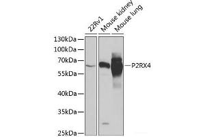 Western blot analysis of extracts of various cell lines using P2RX4 Polyclonal Antibody at dilution of 1:1000. (P2RX4 anticorps)