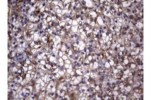 Image no. 12 for anti-Tumor Necrosis Factor Receptor Superfamily, Member 8 (TNFRSF8) (AA 19-379) antibody (ABIN1491084)