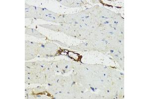 Immunohistochemistry of paraffin-embedded mouse heart using Complement factor B (CFB) antibody (ABIN3015549, ABIN3015550, ABIN3015551, ABIN1679188 and ABIN6218807) at dilution of 1:200 (40x lens). (Complement Factor B anticorps  (AA 80-420))