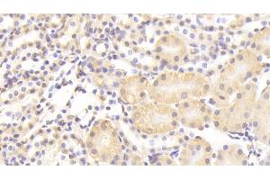 Detection of NUP133 in Mouse Kidney Tissue using Polyclonal Antibody to Nucleoporin 133 (NUP133) (NUP133 anticorps  (AA 36-240))