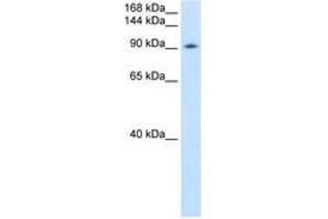 Image no. 1 for anti-DEAD (Asp-Glu-Ala-Asp) Box Polypeptide 54 (DDX54) (AA 661-710) antibody (ABIN6736604) (DDX54 anticorps  (AA 661-710))