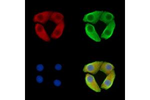 anti-Ly6/Plaur Domain Containing 1 (LYPD1) antibody