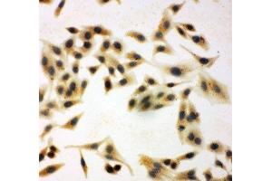 ICC testing of NRG1 antibody and HeLa cells (Neuregulin 1 anticorps  (C-Term))