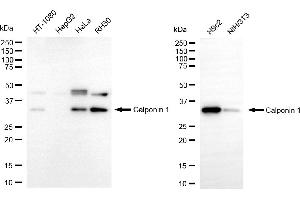 Western blotting analysis using calponin 1 antibody (ABIN7797851). (Recombinant CNN1 anticorps)