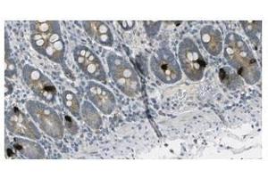 Image no. 1 for anti-Gastric Inhibitory Polypeptide (GIP) antibody (ABIN355181) (GIP anticorps)
