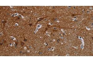 Immunohistochemistry of paraffin-embedded Human brain tissue using PCDHB15 Polyclonal Antibody at dilution 1:50