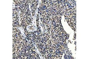 IHC analysis of MTA2 using anti-MTA2 antibody (ABIN7599519). (MTA2 anticorps  (AA 1-668))