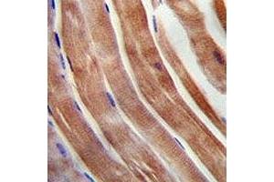 KEAP1 antibody immunohistochemistry analysis in formalin fixed and paraffin embedded human skeletal muscle. (KEAP1 anticorps  (AA 422-449))