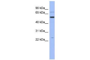 WB Suggested Anti-ZCRB1 Antibody Titration:  0. (ZCRB1 anticorps  (N-Term))