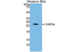 Western Blotting (WB) image for anti-Aggrecan (ACAN) (AA 2163-2316) antibody (ABIN1175194) (Aggrecan anticorps  (AA 2163-2316))