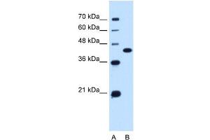 SLC14A1 antibody used at 0.