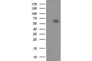 Western Blotting (WB) image for anti-Calcium Binding and Coiled-Coil Domain 2 (CALCOCO2) antibody (ABIN1497076) (CALCOCO2 anticorps)