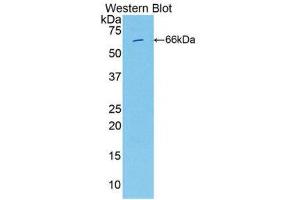 Western Blotting (WB) image for anti-Integrin beta 2 (ITGB2) (AA 451-627) antibody (ABIN1859503)