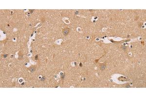 Immunohistochemistry of paraffin-embedded Human brain tissue using CDK11A/B Polyclonal Antibody at dilution 1:50 (Cdk11A/B anticorps)