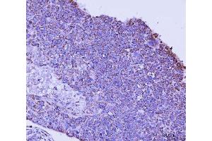 IHC analysis of TFEB using anti-TFEB antibody (ABIN7600648).