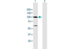 Western Blot analysis of MCC expression in transfected 293T cell line by MCC MaxPab polyclonal antibody. (MCC anticorps  (AA 1-829))