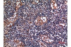 Immunohistochemistry (IHC) analysis of paraffin-embedded Human Lymph Gland, antibody was diluted at 1:100. (Cytokeratin 19 anticorps  (C-Term))