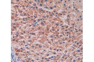 Used in DAB staining on fromalin fixed paraffin- embedded liver tissue