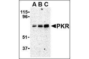 Western blot analysis of PKR in A431 whole cell lysate with this product at (A) 0. (EIF2AK2 anticorps  (C-Term))