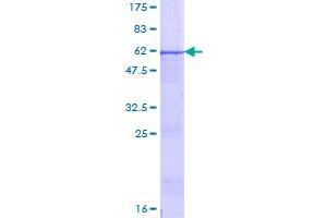 Image no. 1 for Protease, serine, 1 (Trypsin 1) (PRSS1) (AA 1-247) protein (GST tag) (ABIN1316466)