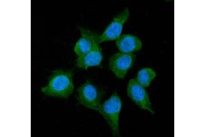 IF analysis of ADH1A using anti-ADH1A antibody (ABIN4886427). (ADH1A anticorps  (AA 213-375))