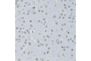 Immunohistochemistry of paraffin-embedded mouse brain using CREB1 Antibody. (CREB1 anticorps)