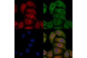 ABIN6256529 and ABIN6267184 staining heat-shock treated Hela cells by IF/ICC.