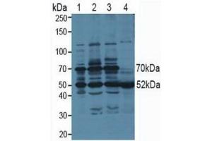 Western blot analysis of (1) Human 293T cells, (2) Human HeLa cells, (3) Human HepG2 cells and (4) Human Saliva Tissue. (PSMC3 anticorps  (AA 2-439))