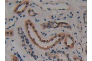 Detection of CKMT1A in Human Kidney Tissue using Polyclonal Antibody to Creatine Kinase, Mitochondrial 1A (CKMT1A)
