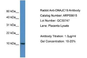 WB Suggested Anti-DNAJC19  Antibody Titration: 0. (DNAJC19 anticorps  (C-Term))