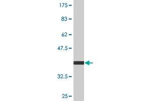 Western Blot detection against Immunogen (38.