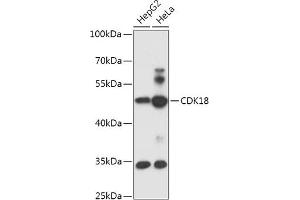 Western blot analysis of extracts of various cell lines, using CDK18 antibody (ABIN7266581) at 1:1000 dilution. (CDK18 anticorps  (AA 373-474))