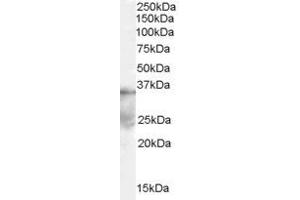 Western Blotting (WB) image for anti-Autophagy related 4A Cysteine Peptidase (ATG4A) (Middle Region) antibody (ABIN2787881) (ATG4A anticorps  (Middle Region))