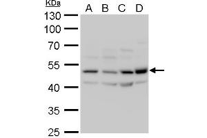 WB Image CaMK2D antibody detects CaMK2D protein by western blot analysis. (CAMK2D anticorps)