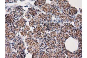 Image no. 9 for anti-Catenin (Cadherin-Associated Protein), beta 1, 88kDa (CTNNB1) antibody (ABIN1496894)