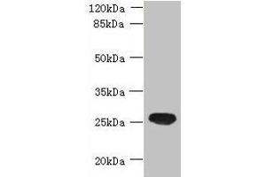 Western blot All lanes: ENKD1 antibody at 7 μg/mL + Mouse brain tissue Secondary Goat polyclonal to rabbit IgG at 1/10000 dilution Predicted band size: 39, 26 kDa Observed band size: 26 kDa (ENKD1 anticorps  (AA 1-346))