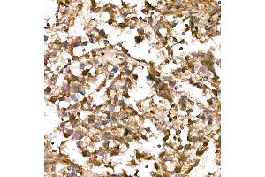 Immunohistochemistry of paraffin-embedded Human testicular seminoma using NY-ESO-1 Rabbit pAb (ABIN6131864, ABIN6143238, ABIN6143239 and ABIN6221674) at dilution of 1:200 (40x lens). (LIN28A anticorps  (AA 142-209))