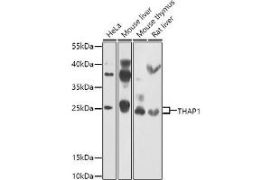 Western blot analysis of extracts of various cell lines, using TH antibody (ABIN6128823, ABIN6149105, ABIN6149106 and ABIN6223361) at 1:1000 dilution. (THAP1 anticorps  (AA 1-213))