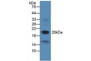 Figure. (Dual Specificity Phosphatase 3 (DUSP3) (AA 2-185) anticorps)