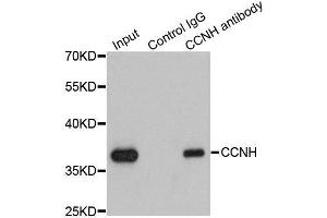 Immunoprecipitation analysis of 200ug extracts of K562 cells using 1ug CCNH antibody.