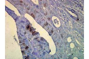 Image no. 1 for anti-Heat Shock Protein 70 (HSP70) (AA 436-503) antibody (ABIN466875) (HSP70 anticorps  (AA 436-503))