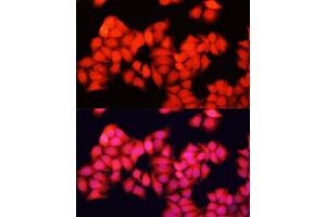 Immunofluorescence analysis of HeLa cells using ARAF antibody  at dilution of 1:100. (ARAF anticorps  (AA 371-606))