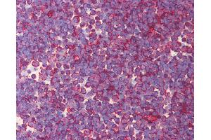 Anti-EOMES antibody IHC of human thymus.