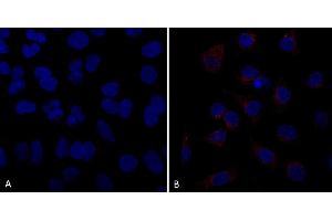 Immunocytochemistry/Immunofluorescence analysis using Mouse Anti-VPS35 Monoclonal Antibody, Clone 10A8 (ABIN6932981). (VPS35 anticorps  (Atto 390))