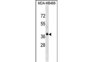Western blot analysis in MDA-MB468 cell line lysates (35ug/lane).