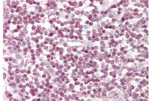 Rabbit Anti-TFCP2 antibody Catalog Number: ARP31073 Formalin Fixed Paraffin Embedded Tissue: Human Tonsil Primary antibody Concentration: 1:200 Secondary Antibody: Donkey anti-Rabbit-Cy3 Secondary Antibody Concentration: 1:200 Magnification: 20x Exposure Time: 0.